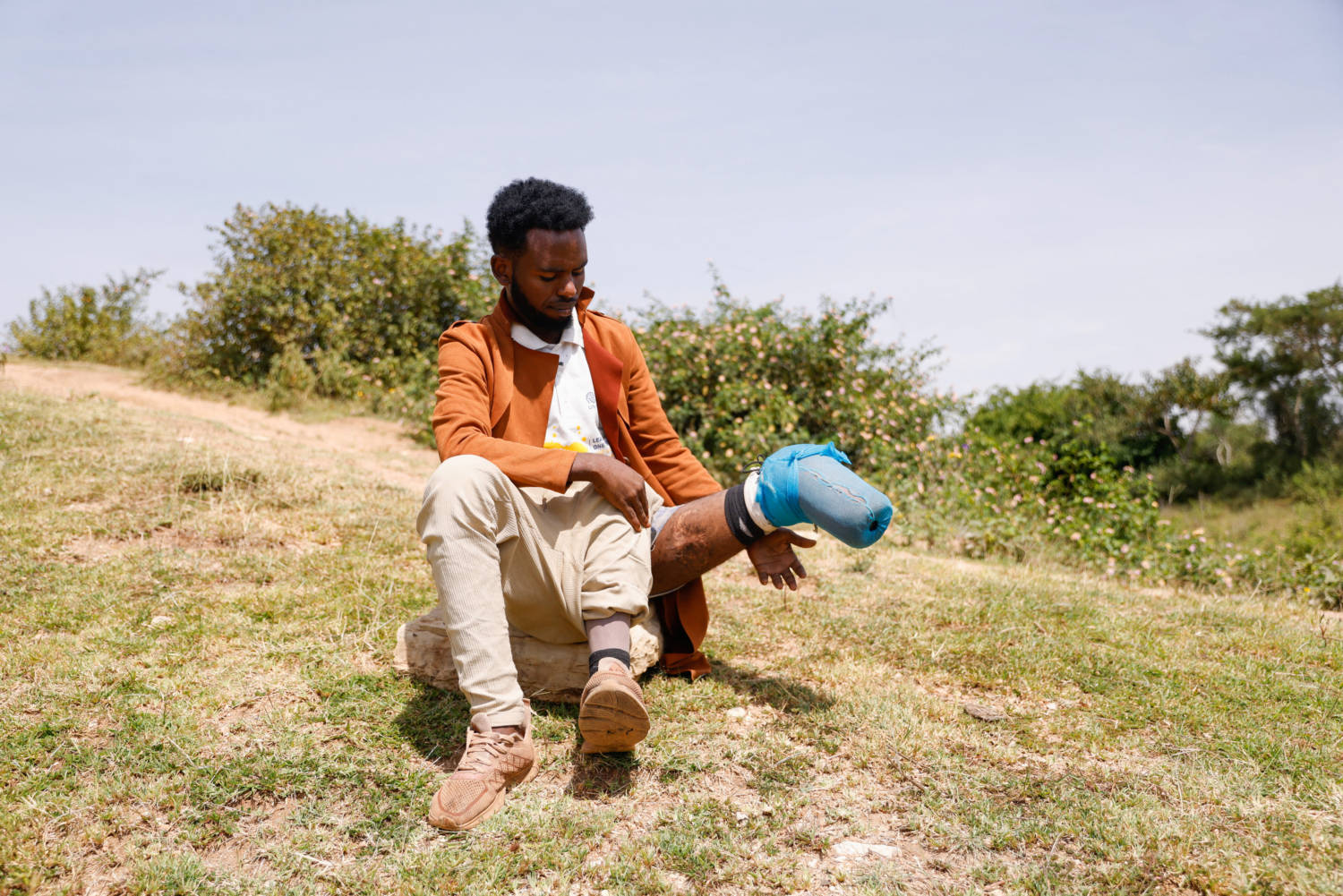 Mustafa Sofian After Being Repatriated By The Iom, In Harar